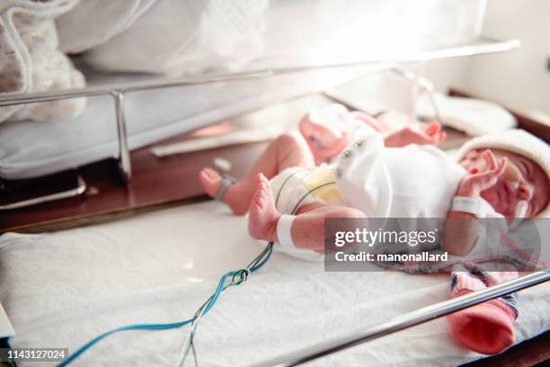 premature baby girl feet plugging in to oxygen machine. - nasal cannula stock pictures, royalty-free photos & images