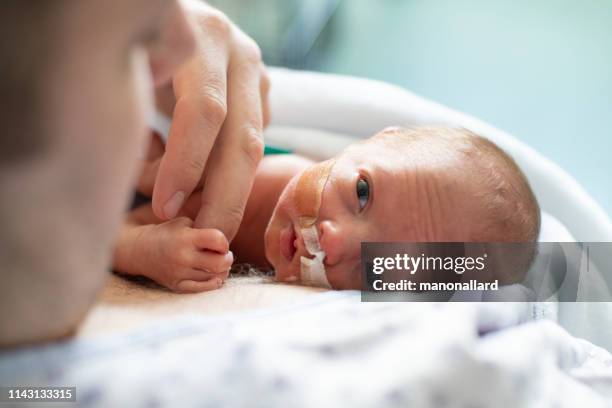 vater kümmert sich um sein frühgeborenes, das im krankenhaus die haut in die haut geht - premature baby stock-fotos und bilder