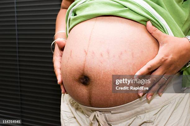 pregnant with stretch marks - stretch mark stock pictures, royalty-free photos & images