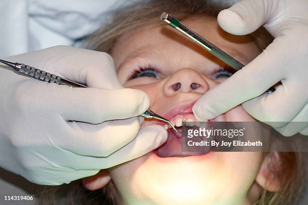 young girl gets dental exam cavitie - dental filling stockfoto's en -beelden