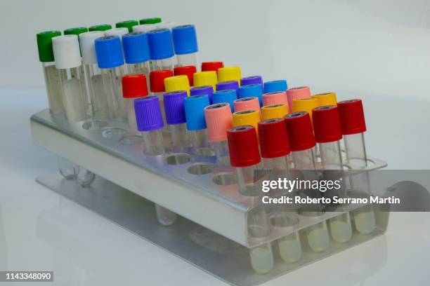 laboratory tubes - reageerbuisrek stockfoto's en -beelden