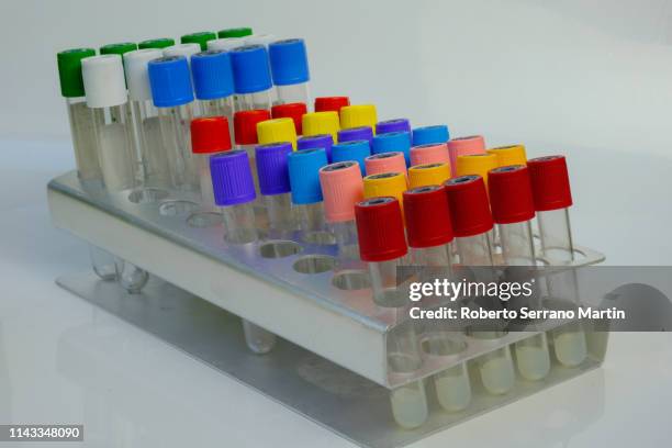 Tan Lab Tube Laboratory Tubes High-Res Stock Photo - Getty Images