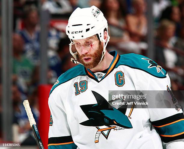 Joe Thornton of the San Jose Sharks sports a ct below his eye after a high stick during their loss to the Vancouver Canucks in Game Two of the...
