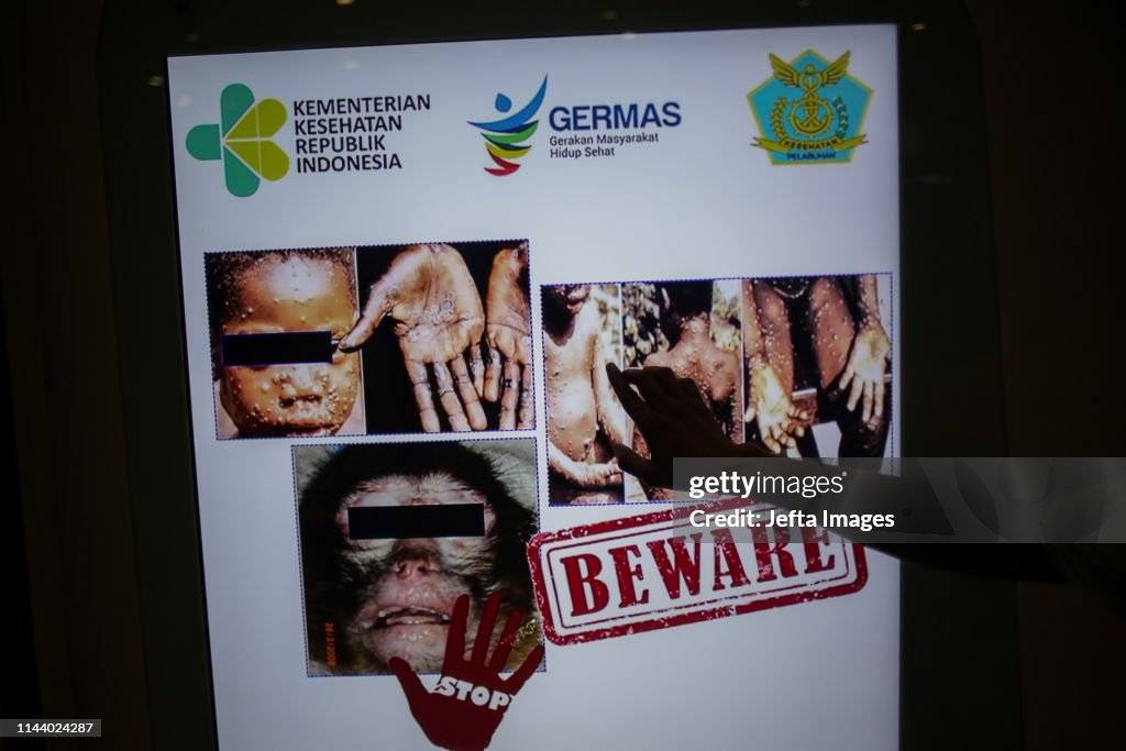 Monkeypox virus detection in Indonesia