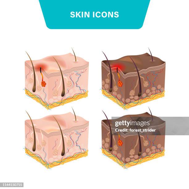 hau-epidermis icons - keratosis stock-grafiken, -clipart, -cartoons und -symbole