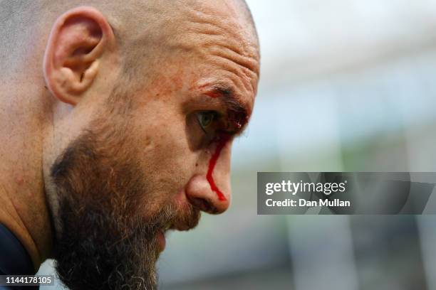 Scott Fardy of Leinster leaves the field with a cut to his head following the Heineken Champions Cup Semi Final match between Leinster Rugby and...