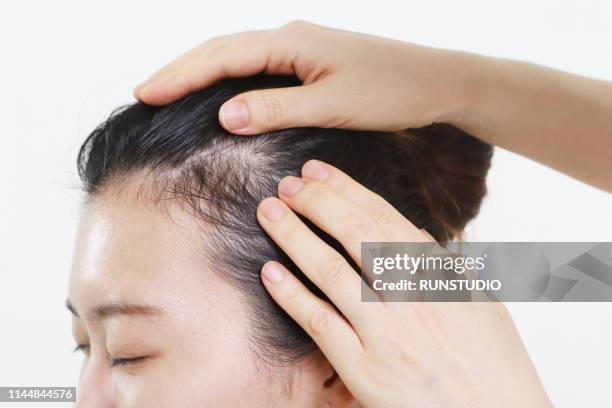 dermatologist examining patient's scalp - doctor looking down stock pictures, royalty-free photos & images