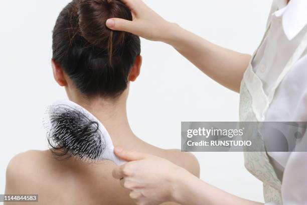 dermatologist checking patient's scalp - caspa fotografías e imágenes de stock