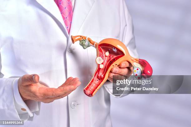 obstetrician–gynecologist in white lab coat discussing common pathologies, diseases shown - ovary stock-fotos und bilder