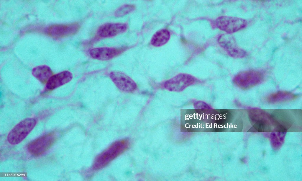 MESENCHYME--UNDIFFERENTIATED CONNECTIVE TISSUE, also called EMBRYONIC CONNECTIVE TISSUE, 400X