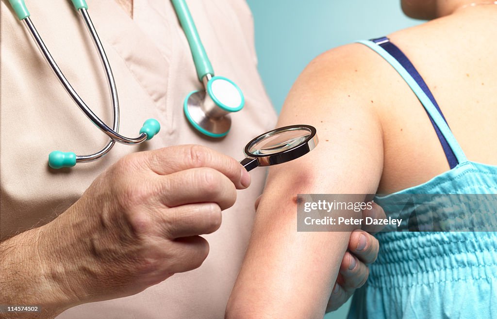 Doctor examining woman with melanoma