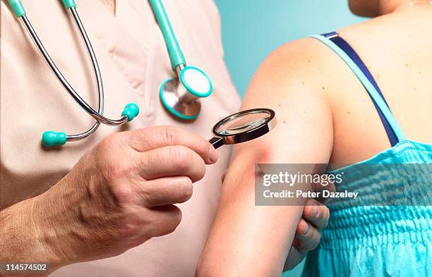 doctor examining woman with melanoma - dermatología fotografías e imágenes de stock