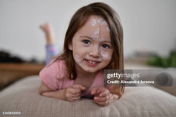 chickenpox - chickenpox stock pictures, royalty-free photos & images