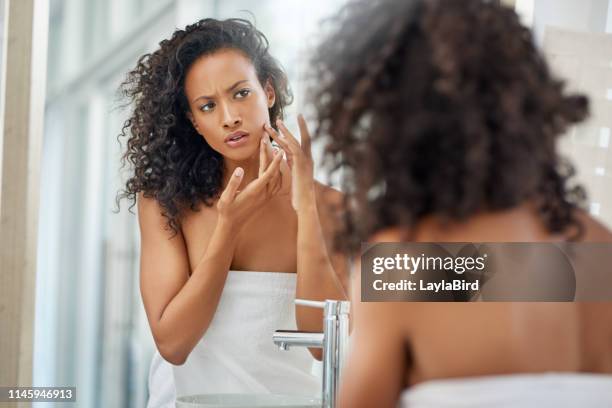 tijd voor sommige anti acne cream - acnes stockfoto's en -beelden