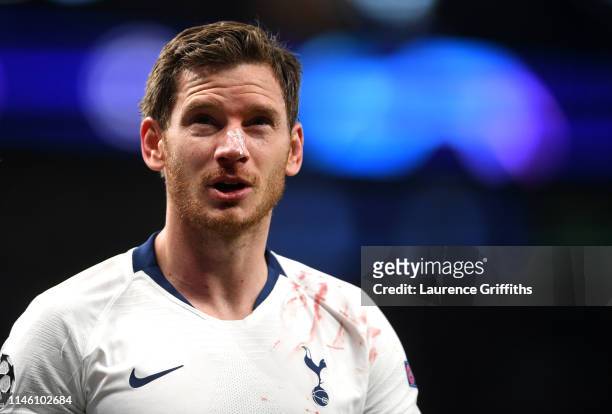 Jan Vertonghen of Tottenham Hotspur is injured during the UEFA Champions League Semi Final first leg match between Tottenham Hotspur and Ajax at at...