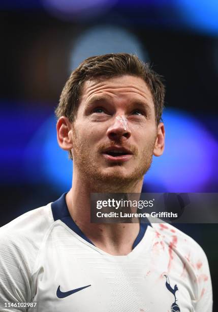 Jan Vertonghen of Tottenham Hotspur is injured during the UEFA Champions League Semi Final first leg match between Tottenham Hotspur and Ajax at at...