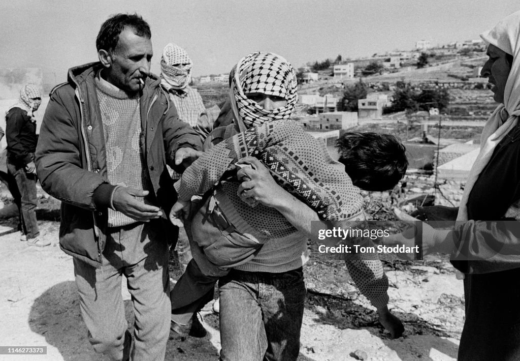 Injured Child In The West Bank