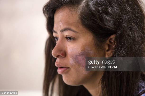 Indian Everest climber Ameesha Chauhan speaks during an interview with AFP at a hospital in Kathmandu on May 27, 2019. - Ameesha Chauhan, a survivor...
