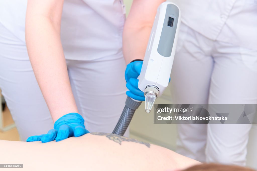 Procedure removal tattoo in laser cosmetology clinic.