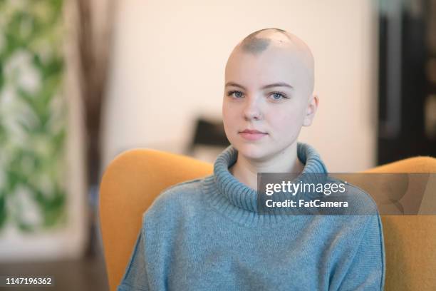 vrouw met kanker drinken - alopecia stockfoto's en -beelden