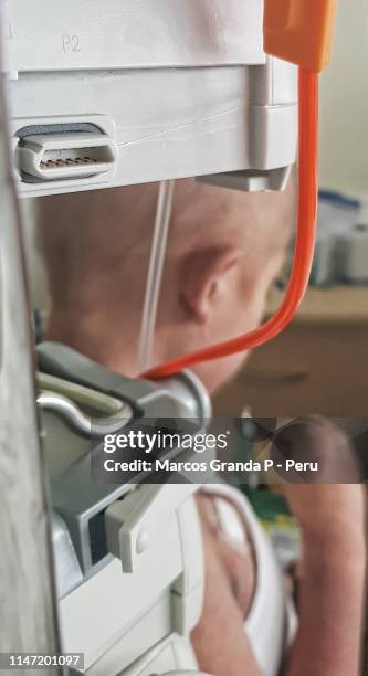 tratamiento del cáncer infantil - cancer infantil stock-fotos und bilder