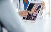 Imaging evaluation is crucial in confirming a diagnosis
