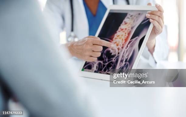 imaging evaluation is crucial in confirming a diagnosis - backbone stock pictures, royalty-free photos & images