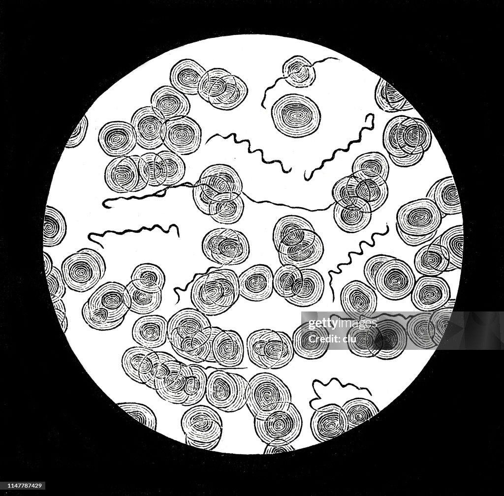 Typhoid bacterium under the microscope
