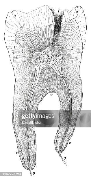 sick tooth, cross section - toothache cartoon stock illustrations