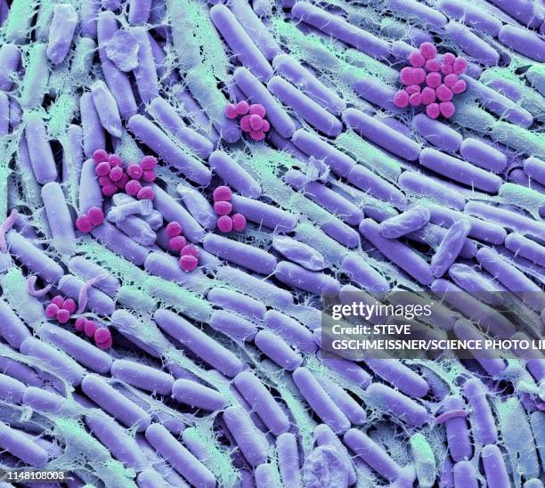 breast milk bacteria, sem - estafilococo fotografías e imágenes de stock