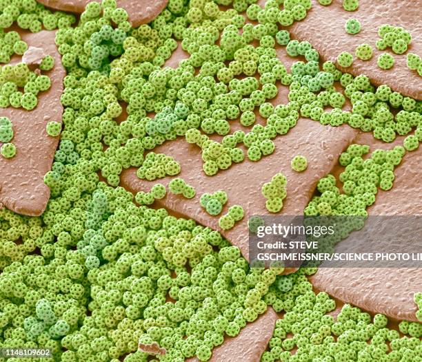 brochosomes, sem - micrografía electrónica escaneadora fotografías e imágenes de stock