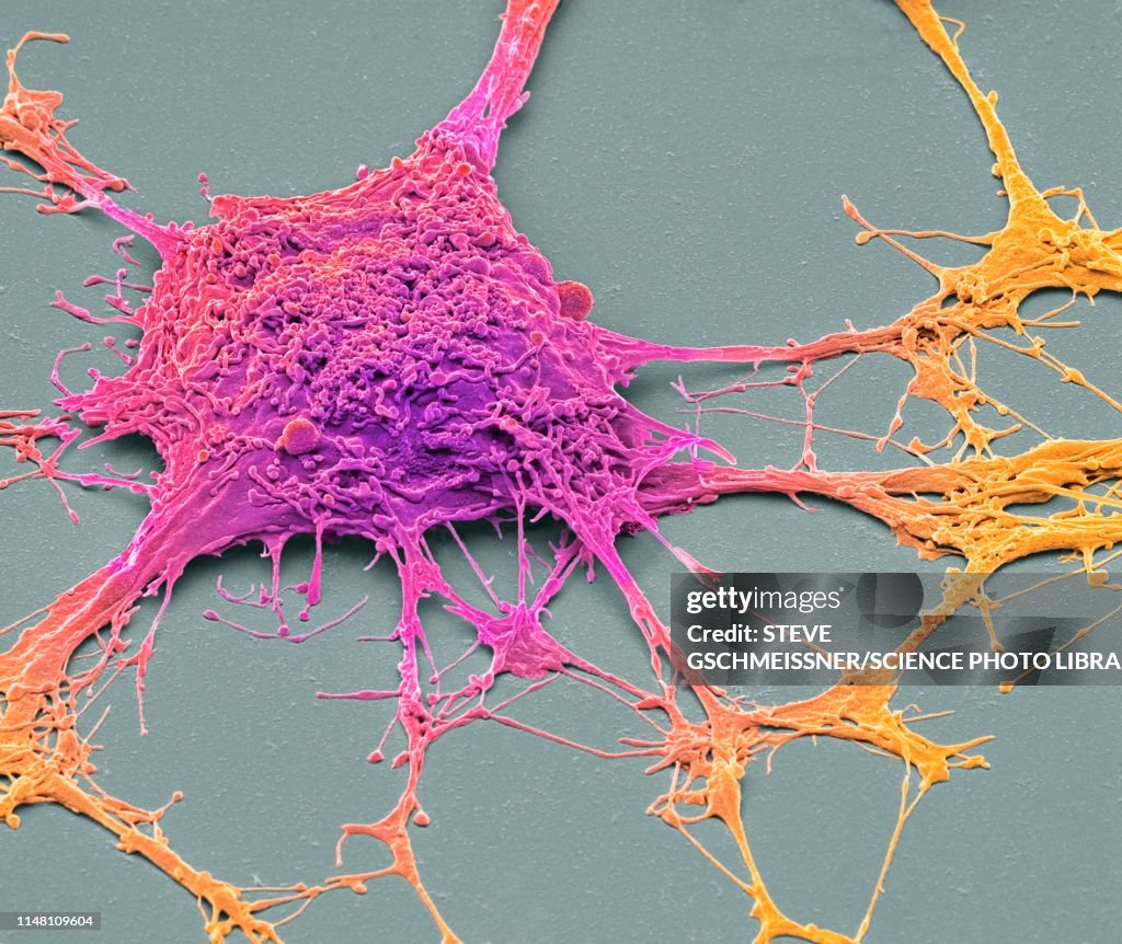 Neurone, SEM