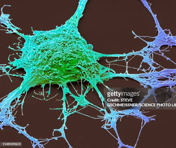 neurone, sem - microscopio elettronico a scansione foto e immagini stock