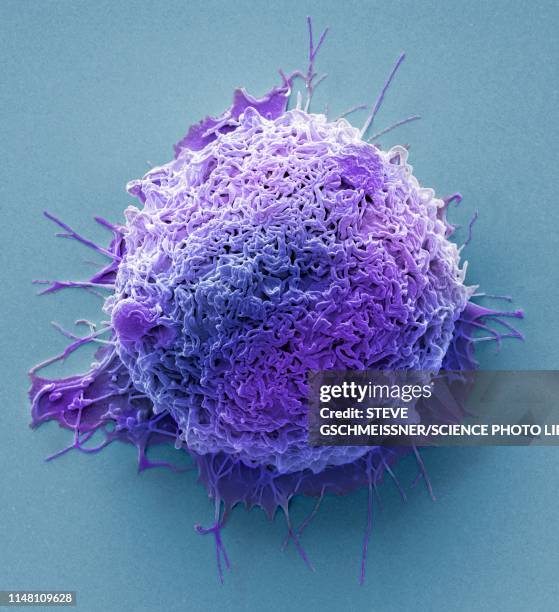colorectal cancer cell, sem - colorectal cancer stockfoto's en -beelden
