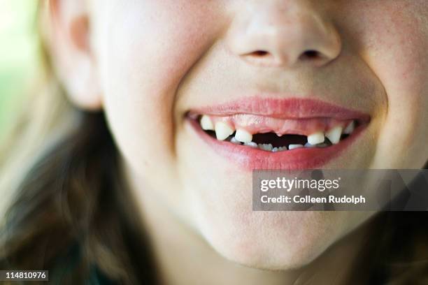 young girl showing off her missing teeth - rudolph stock pictures, royalty-free photos & images