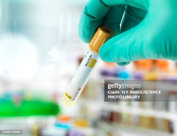 hepatitis test - hepatite imagens e fotografias de stock