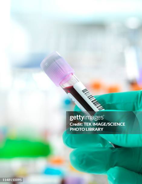 blood test - blood tubes stockfoto's en -beelden