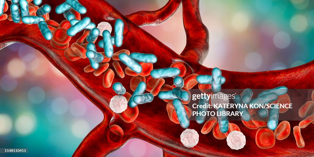 Bacterial blood infection, illustration