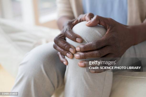 woman with knee pain - human knee stock pictures, royalty-free photos & images