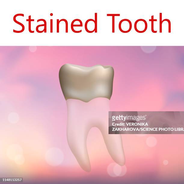 stained tooth, illustration - stained stock illustrations