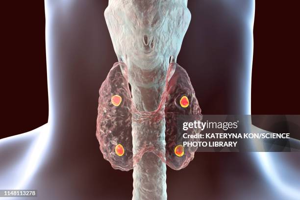 stockillustraties, clipart, cartoons en iconen met parathyroid glands, illustration - human gland