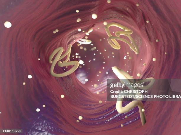 tapeworms in human intestine, illustration - taenia saginata stock illustrations