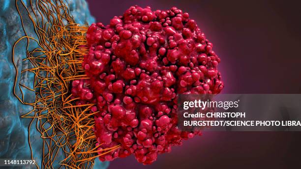 ilustrações, clipart, desenhos animados e ícones de cancer cell, illustration - tumor cerebral