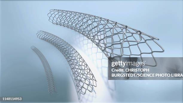 Stent Stent Photos and Premium High Res Pictures - Getty Images