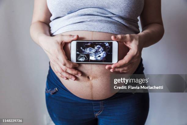 pregnant woman holding a mobile with baby ultrasound - abdomen scan stock pictures, royalty-free photos & images