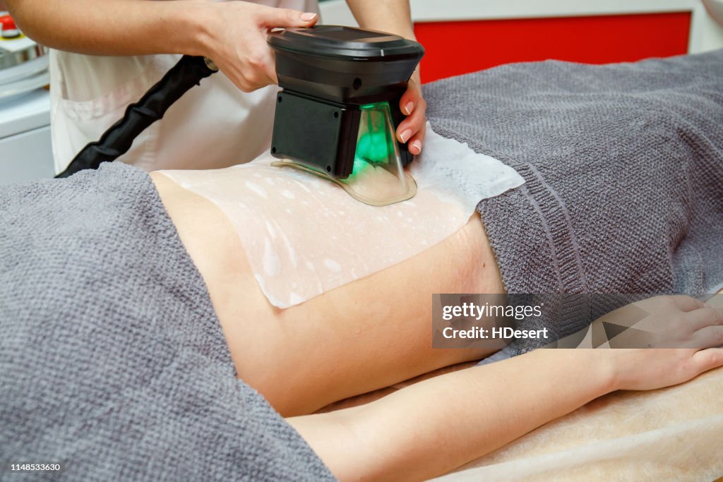 Beauty therapist applying cryolipolysis treatment. Non-surgical fat reduction