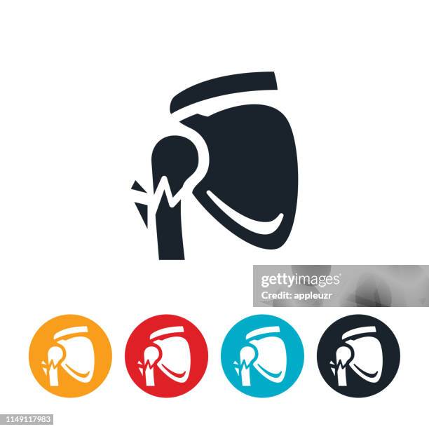 fractured shoulder icon - broken humerus stock illustrations