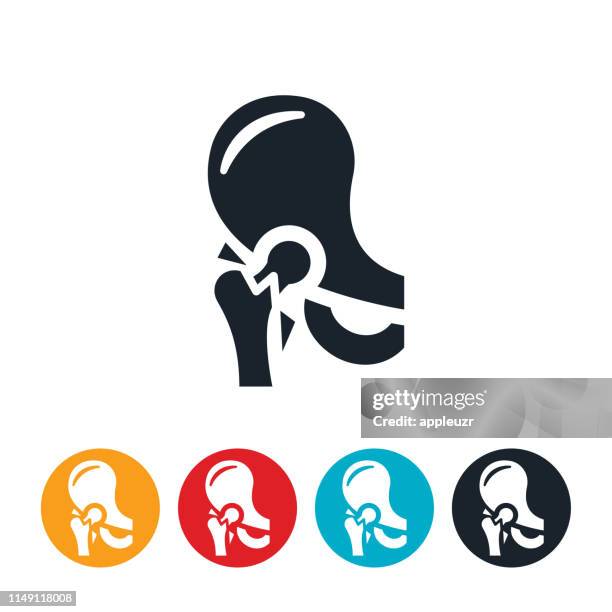 fractured hip icon - femur stock illustrations
