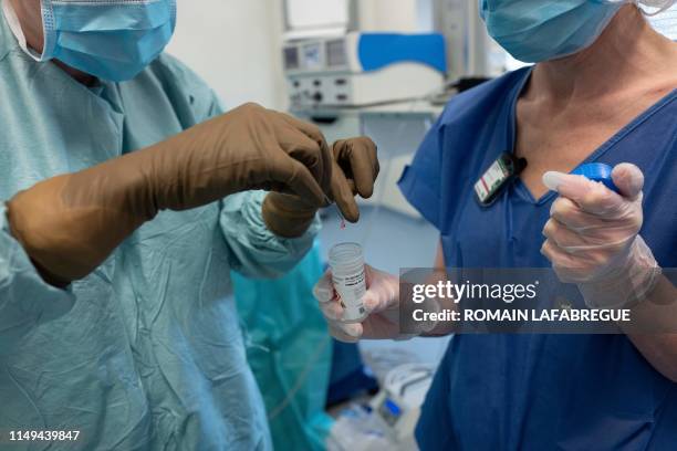 Surgeons place a tissue sample in a test tube on June 7 at the Georges-Francois Leclerc centre in Dijon, central-eastern France, as they treat a...