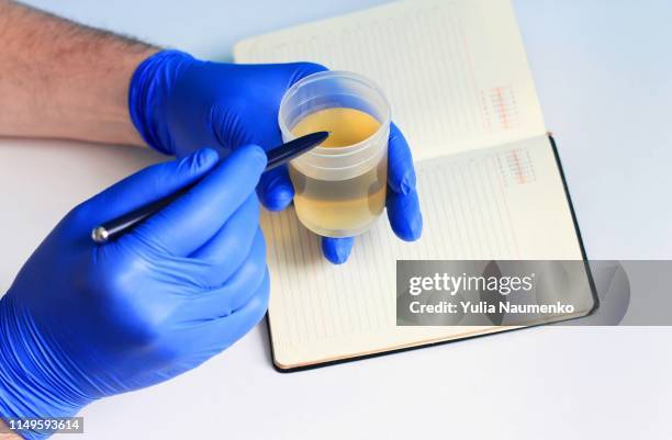 urine in a test jar in hand on a white background - urine sample fotografías e imágenes de stock